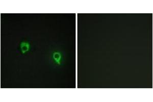 Immunofluorescence analysis of COS7 cells, using AKAP1 Antibody. (AKAP1 Antikörper  (AA 281-330))