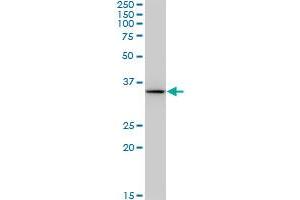 Western Blotting (WB) image for anti-3-hydroxybutyrate Dehydrogenase, Type 1 (BDH1) (AA 1-343) antibody (ABIN513700)