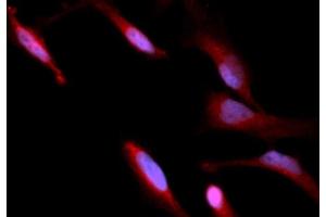 Immunofluorescence (IF) image for anti-Chemokine (C-C Motif) Ligand 22 (CCL22) (AA 25-93) antibody (APC) (ABIN5566343)