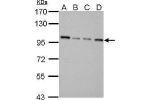 WB Image NNT antibody detects NNT protein by Western blot analysis. (NNT Antikörper  (C-Term))