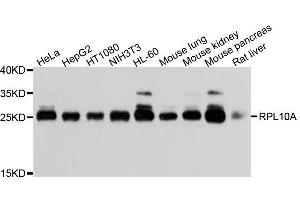 Western blot analysis of extracts of various cell lines, using RPL10A antibody. (RPL10A Antikörper  (AA 1-110))