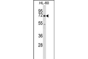 BTK Antibody (N-term) (ABIN657469 and ABIN2846497) western blot analysis in HL-60 cell line lysates (35 μg/lane). (BTK Antikörper  (N-Term))