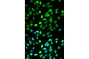 Immunofluorescence analysis of HeLa cell using TCF4 antibody. (TCF4 Antikörper  (AA 400-500))