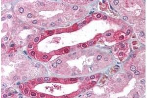 Human Kidney (formalin-fixed, paraffin-embedded stained with CA2 antibody ABIN214022 at 5 ug/ml followed by biotinylated goat anti-rabbit IgG secondary antibody ABIN481713, alkaline phosphatase-streptavidin and chromogen. (CA2 Antikörper)