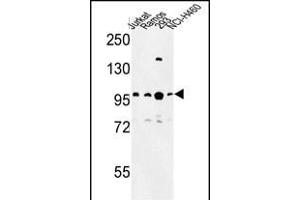 Western blot analysis of BCL11A Antibody (C-term) (ABIN653582 and ABIN2842956) in Jurkat, Ramos, 293, NCI- cell line lysates (35 μg/lane). (BCL11A Antikörper  (C-Term))