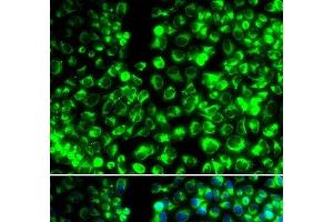 Immunofluorescence analysis of HeLa cells using CALU Polyclonal Antibody