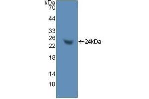 Detection of Recombinant TNPO1, Human using Polyclonal Antibody to Transportin 1 (TNPO1) (Transportin 1 Antikörper  (AA 626-836))