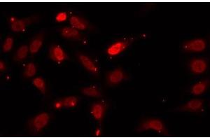 Immunofluorescence analysis of U2OS cells using HNRNPF Polyclonal Antibody (HNRNPF Antikörper)