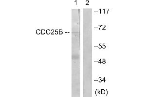 Immunohistochemistry analysis of paraffin-embedded human brain tissue using CDC25B (Ab-353) antibody. (CDC25B Antikörper  (Ser353))