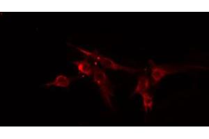 ABIN6274838 staining HeLa cells by IF/ICC. (Amphiphysin Antikörper  (Internal Region))