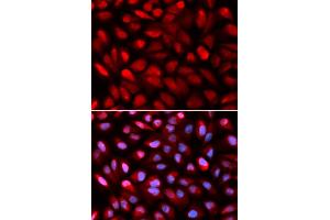 Immunofluorescence analysis of U2OS cells using PCBP2 antibody. (PCBP2 Antikörper)