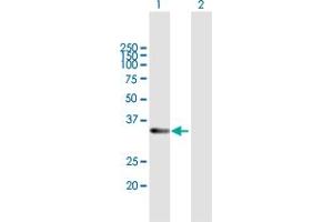 Western Blot analysis of RDH12 expression in transfected 293T cell line by RDH12 MaxPab polyclonal antibody. (RDH12 Antikörper  (AA 1-316))