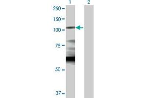 Western Blot analysis of HK1 expression in transfected 293T cell line by HK1 MaxPab polyclonal antibody. (Hexokinase 1 Antikörper  (AA 1-916))