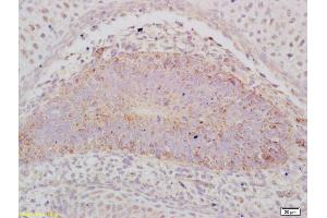 Formalin-fixed and paraffin embedded mouse embryo labeled with Anti-ABCA12 Polyclonal Antibody, Unconjugated (ABIN1386605) at 1:200 followed by conjugation to the secondary antibody and DAB staining (ABCA12 Antikörper  (AA 2051-2200))