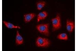 Immunofluorescent analysis of SGK1 staining in HEK293T cells. (SGK1 Antikörper  (C-Term))