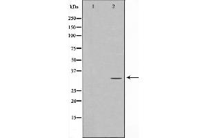 Western blot analysis of RFA2 phosphorylation expression in Adriamycin treated HeLa whole cell lysates,The lane on the left is treated with the antigen-specific peptide. (RPA2 Antikörper  (pThr21))