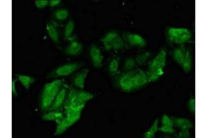 Immunofluorescent analysis of Hela cells using ABIN7163052 at dilution of 1:100 and Alexa Fluor 488-congugated AffiniPure Goat Anti-Rabbit IgG(H+L) (PHF21A Antikörper  (AA 312-487))