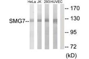 Western Blotting (WB) image for anti-Smg-7 Homolog, Nonsense Mediated mRNA Decay Factor (SMG7) (AA 521-570) antibody (ABIN2889700) (SMG7 Antikörper  (AA 521-570))