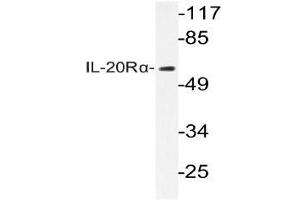 Western blot (WB) analysis of IL-20Rlha antibody in extracts from HepG2 cells. (IL20RA Antikörper)