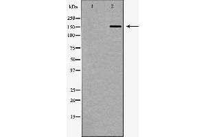 Western blot analysis of Hela whole cell lysates, using FANCD2 Antibody. (FANCD2 Antikörper  (Internal Region))