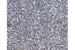 IHC analysis of TOMM40 using anti-TOMM40 antibody (ABIN7599738). (TOMM40 Antikörper  (AA 111-315))