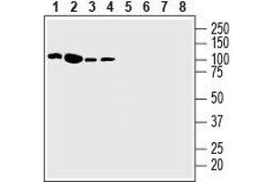 Western blot analysis of human Jurkat T-cell leukemia cell line lysate (lanes 1 and 5), human K562 chronic myelogenous leukemia cell line lysate (lanes 2 and 6), human Malme-3M melanoma cell line lysate (lanes 3 and 7) and human HT-29 colorectal adenocarcinoma cell line lysate (lanes 4 and 8): - 1-4. (EPH Receptor A3 Antikörper  (Extracellular, N-Term))
