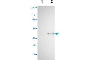 Western blot analysis of Lane 1: Human cell line RT-4, Lane 2: Human cell line U-251MG sp with SPARC polyclonal antibody . (SPARC Antikörper)