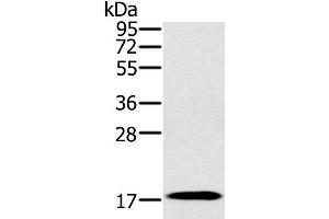 Western Blot analysis of Mouse heart tissue using RNF122 Polyclonal Antibody at dilution of 1:300 (RNF122 Antikörper)
