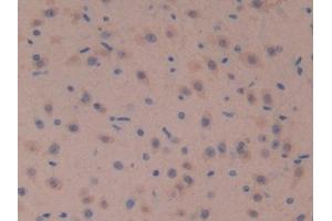 IHC-P analysis of Mouse Brain Tissue, with DAB staining. (SOSTDC1 Antikörper  (AA 24-206))