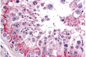 Human Testis: Formalin-Fixed, Paraffin-Embedded (FFPE) (TLN1 Antikörper  (AA 1052-1150))