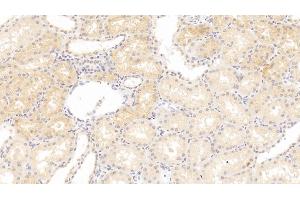 Immunohistochemistry (IHC) image for anti-Lysyl Oxidase (LOX) (AA 213-417) antibody (ABIN7435016)