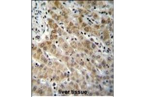 EDN1 Antibody (C-term) (ABIN655912 and ABIN2845311) immunohistochemistry analysis in formalin fixed and paraffin embedded human liver tissue followed by peroxidase conjugation of the secondary antibody and DAB staining. (Endothelin 1 Antikörper  (C-Term))