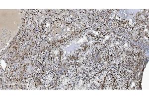 IHC analysis of SAMHD1 using anti-SAMHD1 antibody (ABIN7601514). (SAMHD1 Antikörper  (AA 37-626))