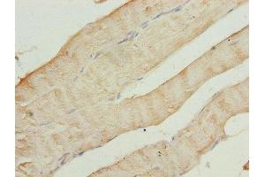 Immunohistochemistry of paraffin-embedded human skeletal muscle tissue using ABIN7143358 at dilution of 1:100 (CAP2 Antikörper  (AA 221-477))