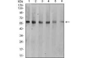 Western Blotting (WB) image for anti-Keratin 10 (KRT10) (AA 345-454) antibody (ABIN5888939) (Keratin 10 Antikörper  (AA 345-454))