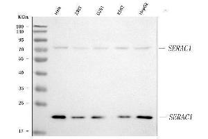 Western blot analysis of SERAC1 using anti-SERAC1 antibody (ABIN7602709).