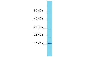 Western Blotting (WB) image for anti-Chromosome 9 Open Reading Frame 170 (C9ORF170) (N-Term) antibody (ABIN2156511) (C9ORF170 Antikörper  (N-Term))