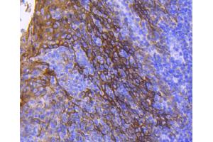 Paraformaldehyde-fixed, paraffin embedded human tonsil, Antigen retrieval by boiling in sodium citrate buffer (pH6) for 15min, Block endogenous peroxidase by 3% hydrogen peroxide for 30 minutes, Blocking buffer at 37°C for 20min, Antibody incubation with Cytokeratin 13 (5A3) Monoclonal Antibody  at 1:50 overnight at 4°C, followed by a conjugated secondary and DAB staining. (Cytokeratin 13 Antikörper)