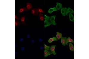 Phospho-Bub1 (Ser459) Antibody staining Hela cells(heat shock treatment) by IF/ICC. (BUB1 Antikörper  (pSer459))