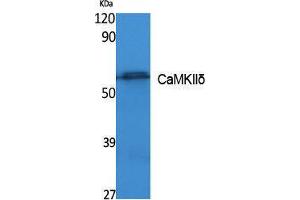 Western Blotting (WB) image for anti-Calcium/calmodulin-Dependent Protein Kinase II delta (CAMK2D) (Internal Region) antibody (ABIN3178095) (CAMK2D Antikörper  (Internal Region))