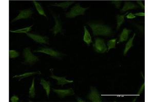Immunofluorescence of monoclonal antibody to RHOA on HeLa cell. (RHOA Antikörper  (AA 1-193))