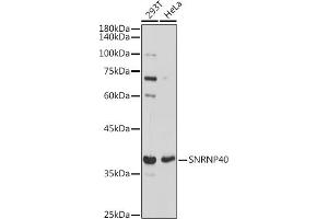 Western blot analysis of extracts of various cell lines, using SNRNP40 antibody (ABIN7270361) at 1:1000 dilution. (SNRNP40 Antikörper)