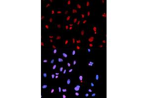 Immunofluorescence analysis of U2OS cells using Phospho-MET-Y1234 antibody (ABIN5969923). (c-MET Antikörper  (pTyr1234))