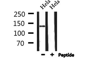 Western Blotting (WB) image for anti-ADAM Metallopeptidase with Thrombospondin Type 1 Motif, 19 (ADAMTS19) (Internal Region) antibody (ABIN6257740)
