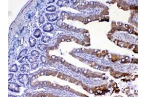 IHC testing of FFPE rat small intestine tissue with UGT1A1 antibody at 1ug/ml. (UGT1A1 Antikörper)