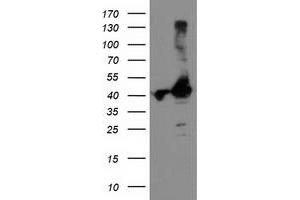 Western Blotting (WB) image for anti-TBC1 Domain Family, Member 21 (TBC1D21) antibody (ABIN1501311) (TBC1D21 Antikörper)