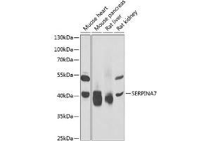 Western blot analysis of extracts of various cell lines, using SERPIN antibody (ABIN6132296, ABIN6147581, ABIN6147582 and ABIN6221920) at 1:1000 dilution. (SERPINA7 Antikörper  (AA 146-415))