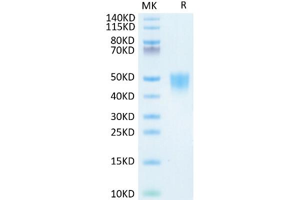 CD200 Protein (CD200) (His tag)