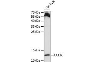Western blot analysis of extracts of Rat liver, using CCL16 antibody (ABIN7266298) at 1:1000 dilution. (CCL16 Antikörper  (AA 1-120))