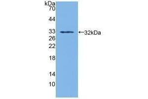 Detection of Recombinant SDH, Human using Polyclonal Antibody to Sorbitol Dehydrogenase (SDH) (SORD Antikörper  (AA 98-355))